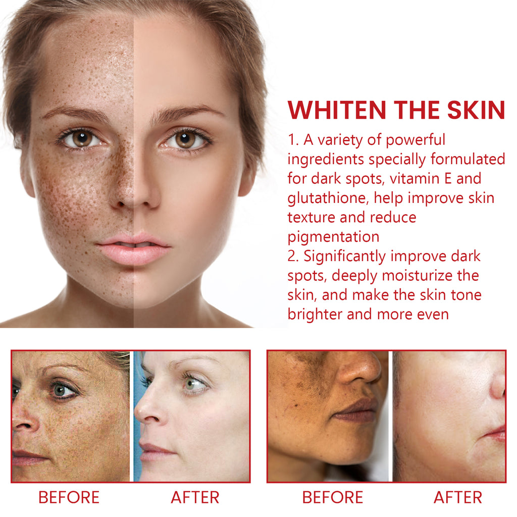 OUHOE Dark Spot Repair Cream, Restores Dull Skin, Lightening Fine Lines And Dark Spots, Brightening Skin Repair Cream