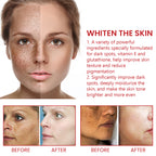 OUHOE Dark Spot Repair Cream, Restores Dull Skin, Lightening Fine Lines And Dark Spots, Brightening Skin Repair Cream