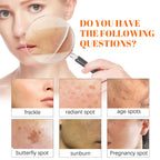 EELHOE Papaya Whitening Freckle Cream Lightens Dark Spots On The Face, Brightens And Moisturizes The Skin Early And Late