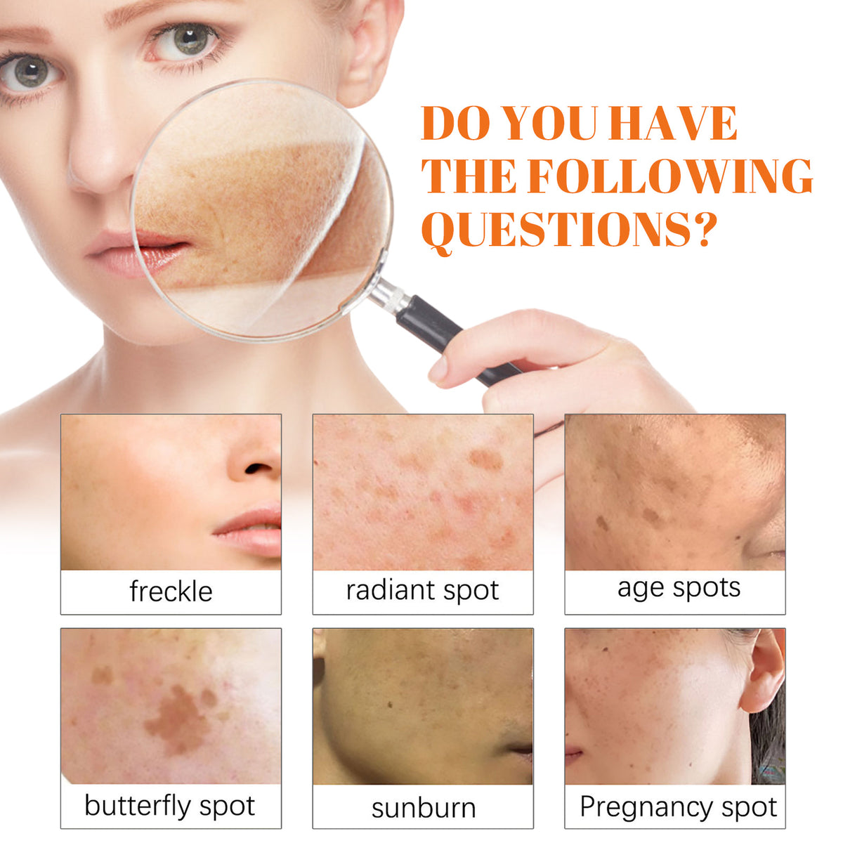 EELHOE Papaya Whitening Freckle Cream Lightens Dark Spots On The Face, Brightens And Moisturizes The Skin Early And Late